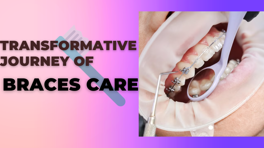 evolution-of-oral-care-for-braces-with-ortho-brush
